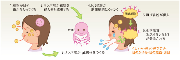 花粉症のメカニズム